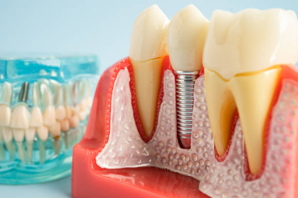 Best Dental Exams and Cleanings  in Belvedere Park, GA